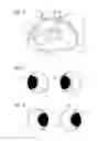 Fig. 05 - Kart with movable visual effect