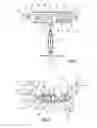 Fig. 04 - Blood filtering device