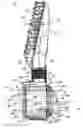 Fig. 01 - Hollow filter element of a filter for filtering fluid, filter, filter housing, and seal of a hollow filter element