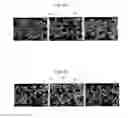 Fig. 05 - METHOD FOR COATING CATALYST ON DIESEL PARTICULATE FILTER