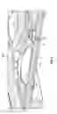 Fig. 06 - Instrument for processing cartridge for performing assays in a closed sample preparation and reaction system