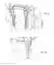 Fig. 06 - WEAR APPARATUS FOR GRINDING ROLLS AND METHODS THEREOF