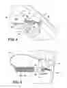 Fig. 05 - Vehicle hood fixture