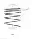 Fig. 04 - TROMMEL ASSEMBLY HAVING A SPIRAL ASSEMBLY WITH DECAYING PITCH