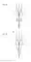 Fig. 04 - Abrasive nozzle head