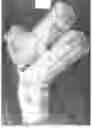Fig. 04 - Mold for forming a joint spacer device or a part thereof