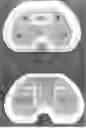 Fig. 07 - Mold for forming a joint spacer device or a part thereof
