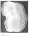 Fig. 10 - Mold for forming a joint spacer device or a part thereof