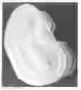 Fig. 11 - Mold for forming a joint spacer device or a part thereof