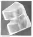 Fig. 14 - Mold for forming a joint spacer device or a part thereof