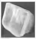 Fig. 17 - Mold for forming a joint spacer device or a part thereof