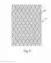 Fig. 25 - METHODS FOR MAKING PATTERNED APERTURED WEBS