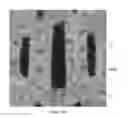 Fig. 20 - Patterned apertured webs and methods for making the same
