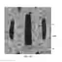 Fig. 20 - Patterned apertured webs and methods for making the same