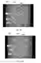 Fig. 26 - Patterned apertured webs and methods for making the same