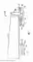 Fig. 02 - Steer axle high-temperature warning system