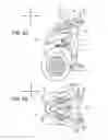 Fig. 10 - Vehicle