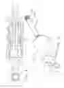 Fig. 05 - Self-dampening tie-rod