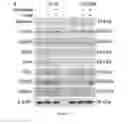Fig. 09 - Selective cancer tracking eradicator and the uses thereof