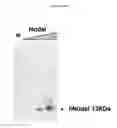 Fig. 14 - Anti-nodal antibodies and methods of using same