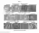 Fig. 19 - Anti-nodal antibodies and methods of using same