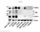 Fig. 20 - Anti-nodal antibodies and methods of using same
