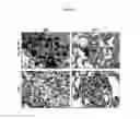 Fig. 76 - Anti-nodal antibodies and methods of using same