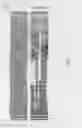 Fig. 14 - ANTI-ILT7 ANTIBODY
