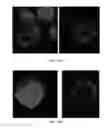 Fig. 29 - Compositions comprising chimeric antigen receptors, T cells comprising the same, and methods of using the same