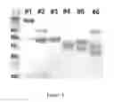 Fig. 04 - Barley with low levels of hordeins