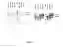 Fig. 08 - Barley with low levels of hordeins
