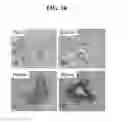 Fig. 12 - Cell populations, methods of transdifferentiation and methods of use thereof