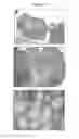 Fig. 02 - METHODS FOR IN VITRO MATURATION OF OVARIAN FOLLICLES