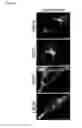 Fig. 05 - METHODS FOR DETECTING PROSTATE CANCER