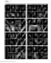 Fig. 07 - METHODS FOR DETECTING PROSTATE CANCER