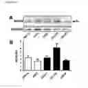 Fig. 46 - METHODS FOR DETECTING PROSTATE CANCER
