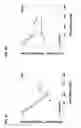 Fig. 10 - PROGNOSTIC METHODS AND SYSTEMS FOR CHRONIC LYMPHOCYTIC LEUKEMIA