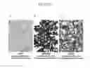 Fig. 02 - SIMULTANEOUS DETECTION OF MUTATIONAL STATUS AND GENE COPY NUMBER