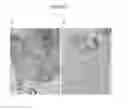 Fig. 08 - SIMULTANEOUS DETECTION OF MUTATIONAL STATUS AND GENE COPY NUMBER