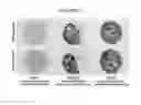 Fig. 10 - SIMULTANEOUS DETECTION OF MUTATIONAL STATUS AND GENE COPY NUMBER