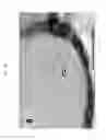 Fig. 03 - Austenitic steel matrix-nanoparticle composite and producing method thereof