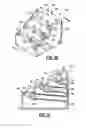 Fig. 12 - Wave suppressor and sediment collection system