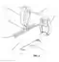 Fig. 04 - Canopy system