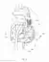 Fig. 10 - Fall arrester