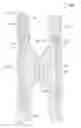 Fig. 01 - Inflatable casing valve
