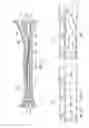 Fig. 04 - Mainbore clean out tool
