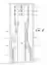Fig. 06 - Electric submersible pump inverted shroud assembly