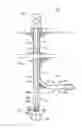Fig. 01 - Computational model for tracking ball sealers in a wellbore