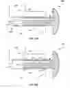 Fig. 11 - MULTI-INJECTION PORT ROTARY ENGINE APPARATUS AND METHOD OF USE THEREOF