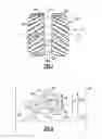 Fig. 04 - TURBINE ENGINE GEARBOX